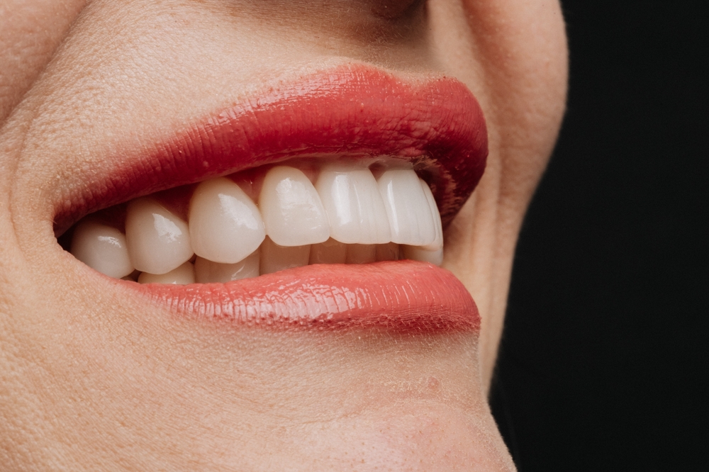 Closeup smile with white porcelain veneers and coral lipstick dental aesthetic beauty