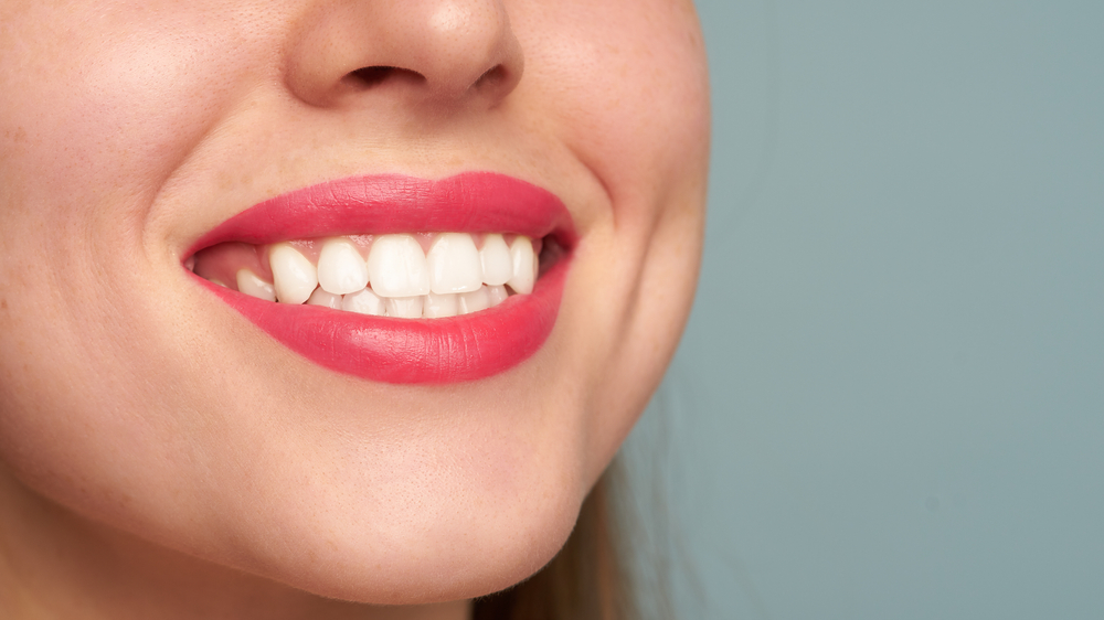 Perfect smile after bleaching. Dental care and teeth whitening. Dentistry and cosmetics.