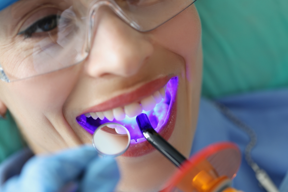 Young woman treating teeth with cordless LED curing light machine closeup