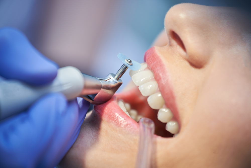 close-up medical dentist procedure of teeth polishing. Dentist making professional teeth cleaning female young female patient at the dental office. Close-up plan